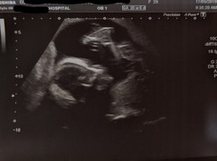 Graduates of the TTC After Pregnancy Loss thread. Aka: The Penguin Huddle