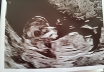 Graduates of the TTC After Pregnancy Loss thread. Aka: The Penguin Huddle