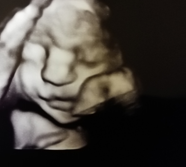 Graduates of the TTC After Pregnancy Loss thread. Aka: The Penguin Huddle