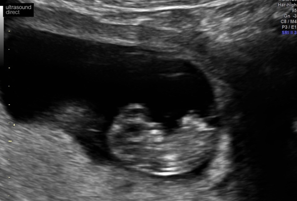 Babies Due May 2020 thread 2