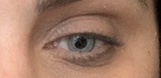 Do my eyelids look puffy/heavy?