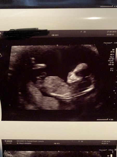 Gender scan tomorrow, what do we think?