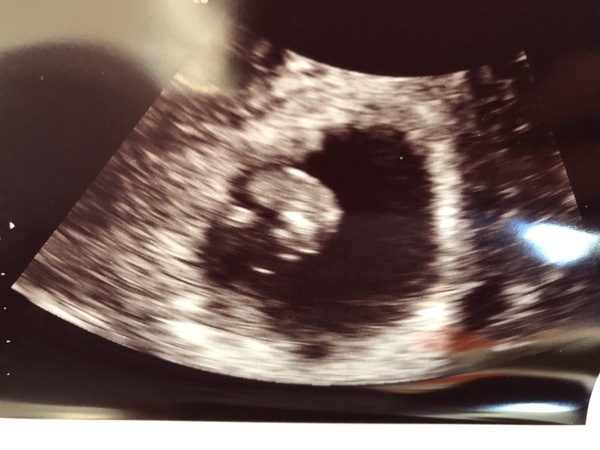 Due May 2020 - could do with a buddy!