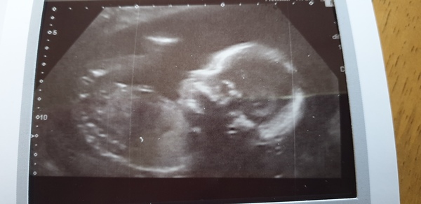 Graduates of the TTC After Pregnancy Loss thread. Aka: The Penguin Huddle