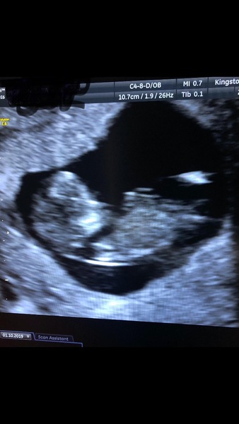 Due May 2020 (thread 3)