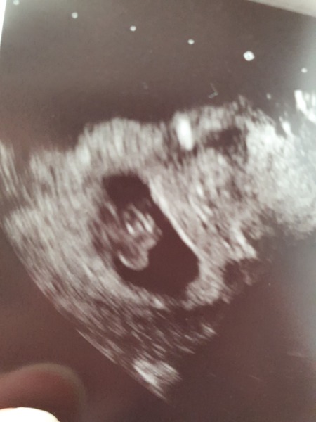 AIBU to even think that I could actually BE pregnant and the test was right after all?