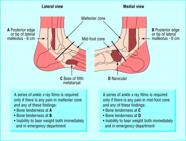 How do you know if you need an X-ray?