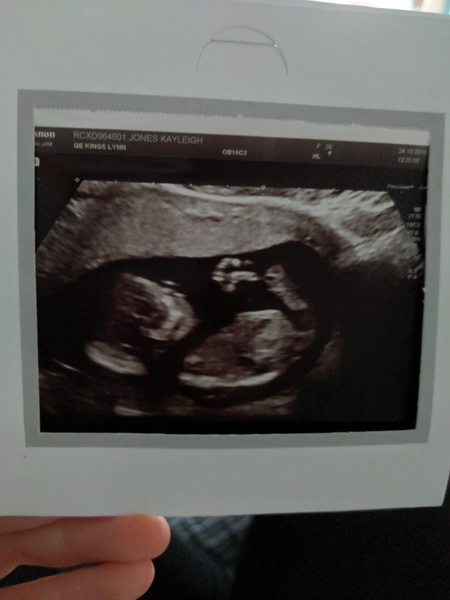 Girl or boy, JUST FOR FUN ♥️
