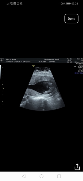 Is this definitely a boy?