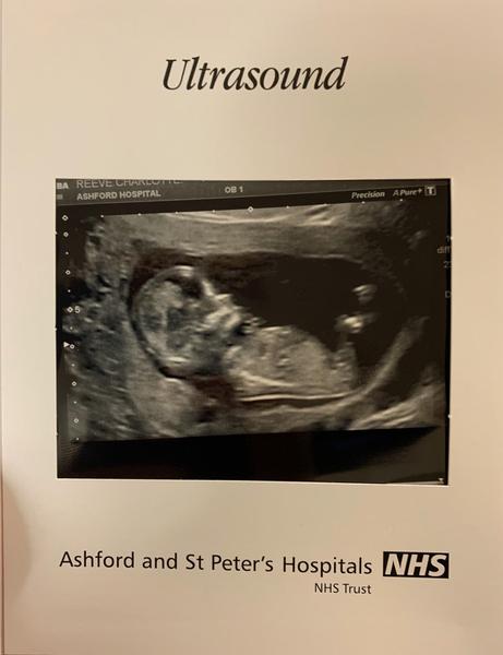 Girl or boy?? 12 week scan, nub??