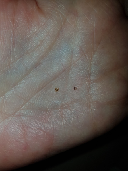 Is this a tick?