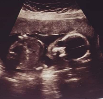 Due May 2020 (thread 3)