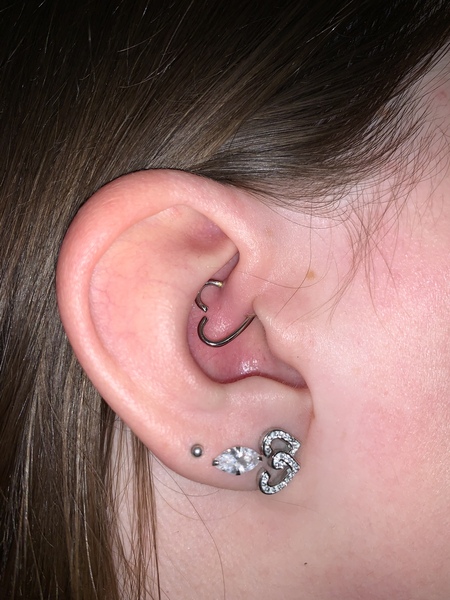 For those with experience of piercings - Does this look normal