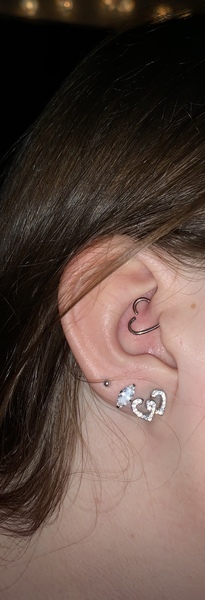 For those with experience of piercings - Does this look normal