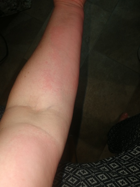 About this random middle of the night rash?!