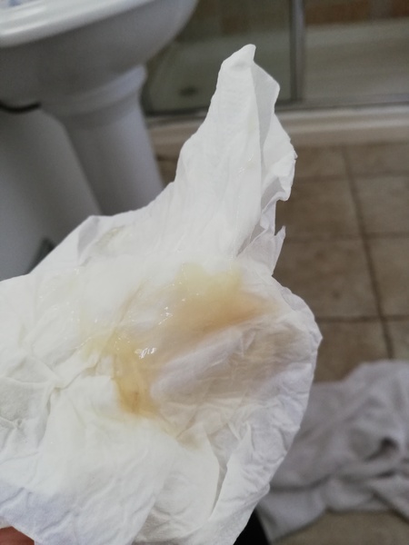 Discharge or mucous plug? *Pic included*