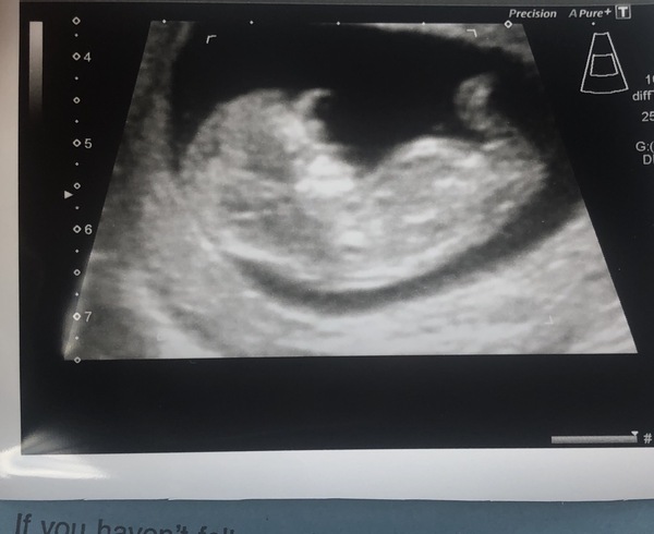 Due May 2020 (thread 3)