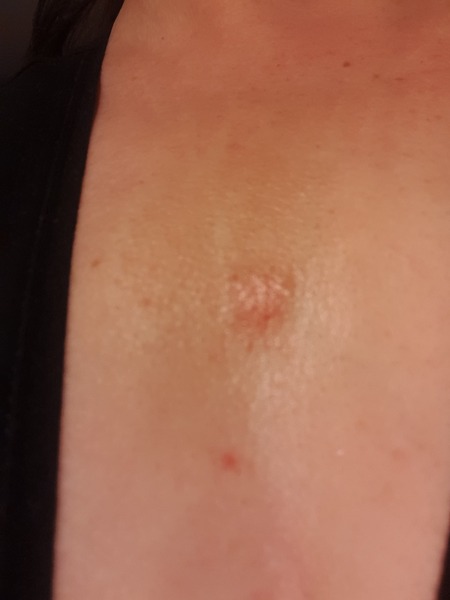 Anyone medical know what this is?