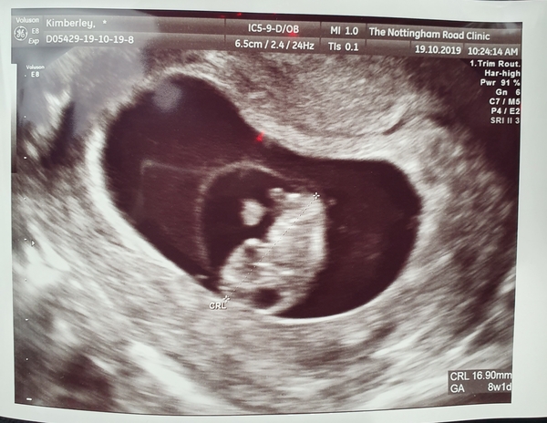 Babies Due May 2020 thread 2