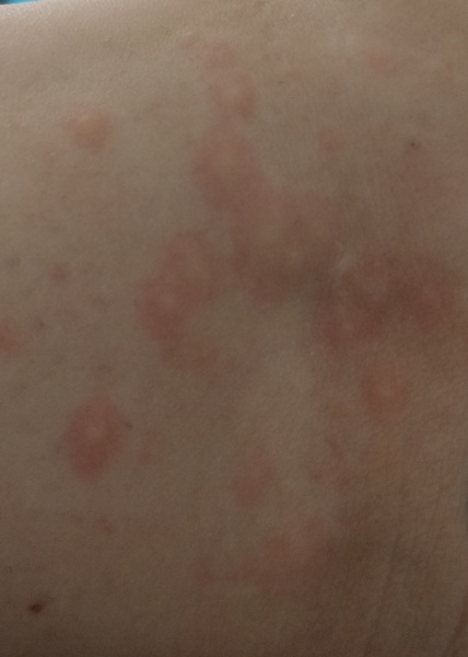 To ask what on Earth this rash is? (Picture!)