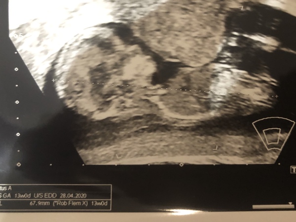 Due May 2020 (thread 3)