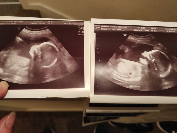 Boy or girl