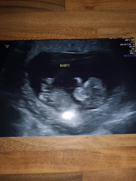 May 2020 - where we get our 12 wks scan and wave goodbye to 1st trimester. hello 2nd trimester