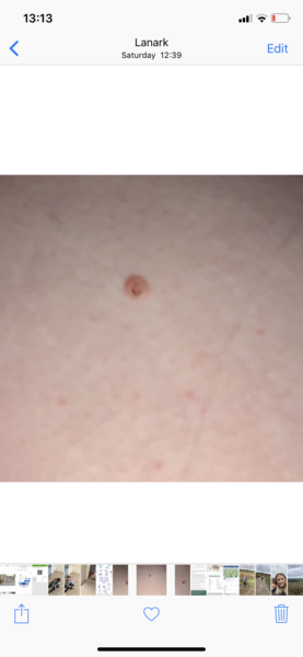 Weird spot