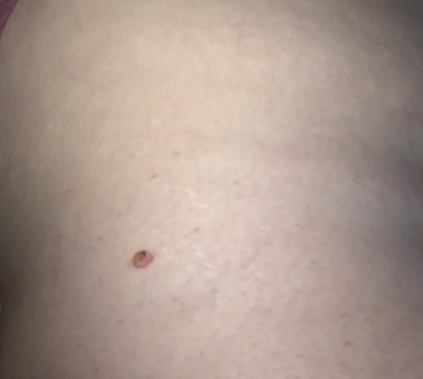 Weird spot