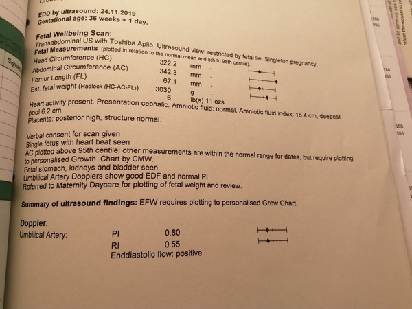 Baby weighs 6lb11oz at 36 weeks?!