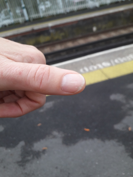 Nail advice sought