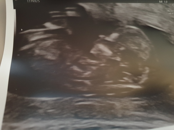 Due May 2020 (thread 3)