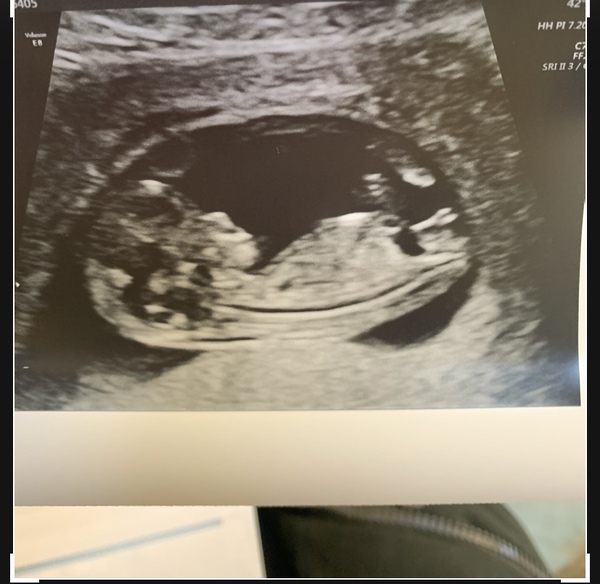 Due May 2020 (thread 3)