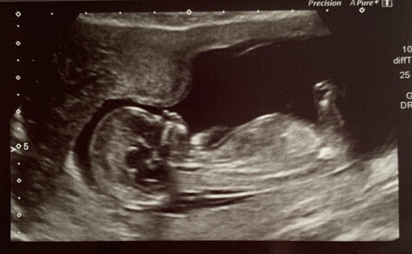 Due May 2020 (thread 3)