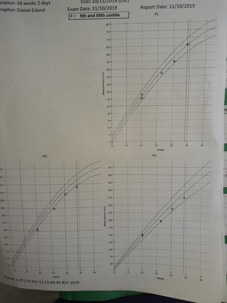 Small head/enlarged ventricles at 20 week anomaly scan - PLEASE READ