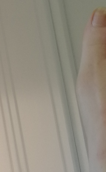 Ffs this is the start of a bunion isn’t it? (Pic included)