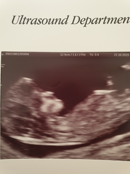 Due May 2020 (thread 3)