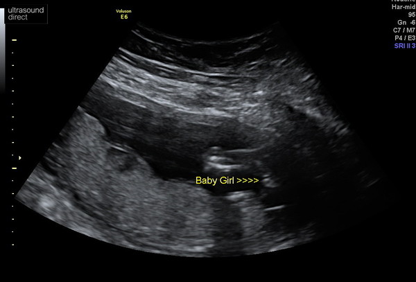 Is this definitely a boy?