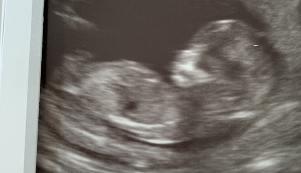 Due May 2020 (thread 3)