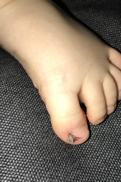 To ask about my toddlers injury? Pic attached