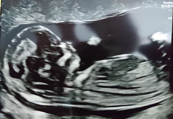 April 2020 Babies - Thread 2!