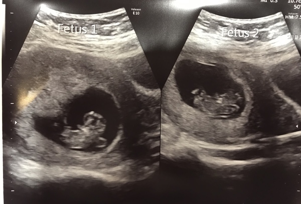 Due May 2020 (thread 3)