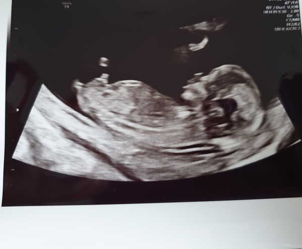 Ideas on gender?