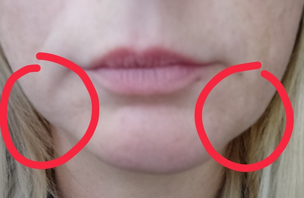 To ask for your recommendations on treatments to tighten the beginnings of the dreaded jowls...