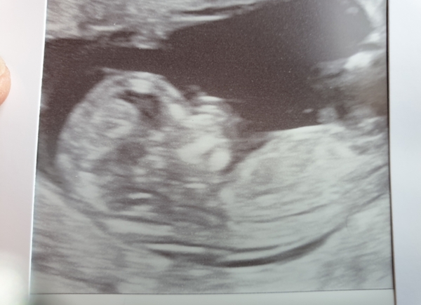 Gender guess....?
