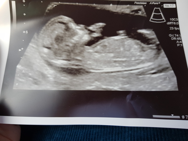 Due May 2020 (thread 3)