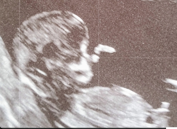 Gender guess....?