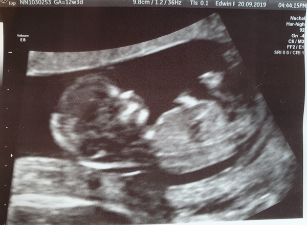 Overweight or plus size and pregnant
