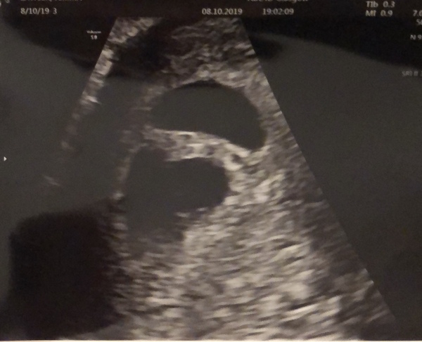Due June 2020...