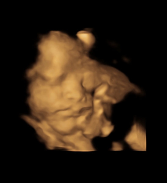 Christmas babies part 2